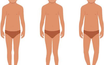 Ginocchio varo e ginocchio valgo